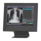 Fujifilm CR Console Workstation Digital X-ray System
